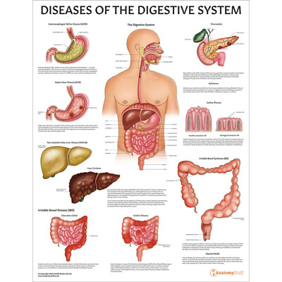 Diseases of the Digestive System Chart / Poster - Laminated